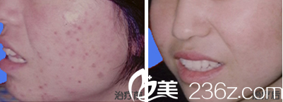 韩国ROCOCO皮肤美容效果 韩国ROCOCO皮肤美容效果