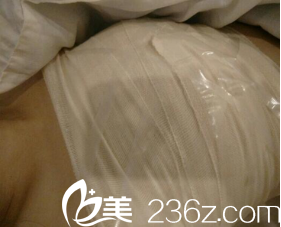 术后三天被包得严严实实