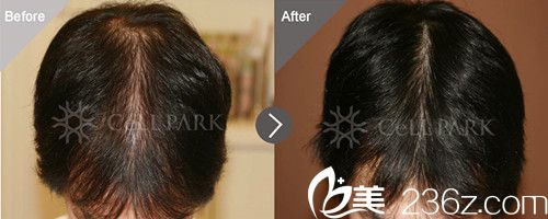 20180806_1533537892306497.jpg 두피.jpg