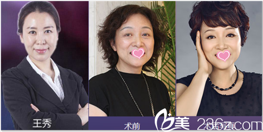 北京美莱王秀祛斑美肤<span style= 北京美莱王秀祛斑美肤<span style=