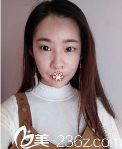 我的术前照片 我的术前照片