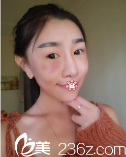 朱晓东医生刚给我做完手术第二天