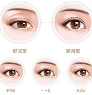 <!--<i data=20240703-sp></i>-->美莱美容医院双眼皮好不好? <!--<i data=20240703-sp></i>-->美莱美容医院双眼皮好不好?