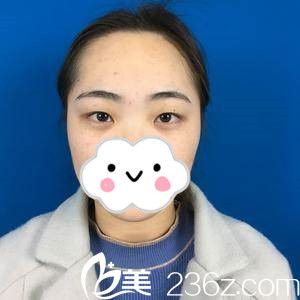 手术前的我 手术前的我