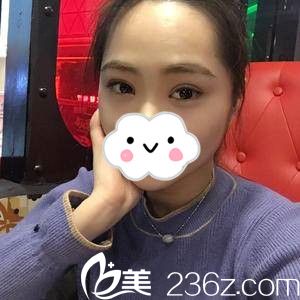 术后一周 术后一周