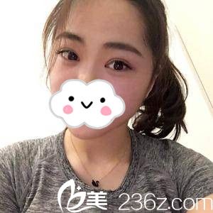 术后半个月 术后半个月