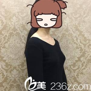 手术前的我 手术前的我