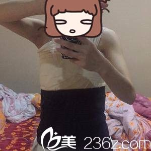 手术后第三天 手术后第三天