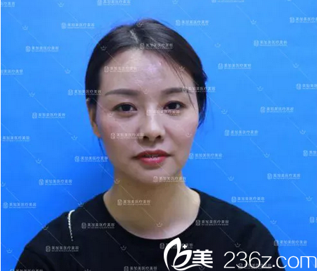 来深圳美加美整形医院整形术前 来深圳美加美整形医院整形术前