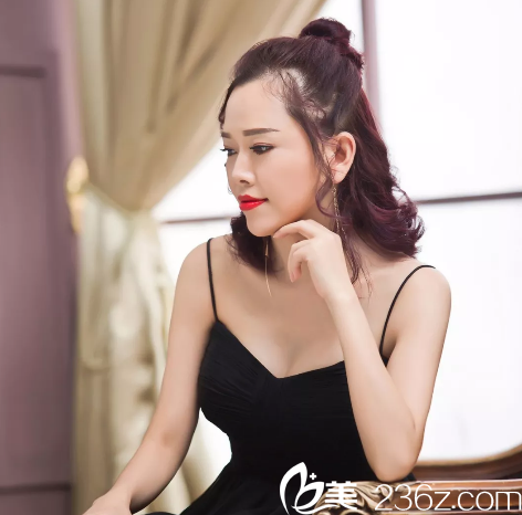 看闺蜜找高山做的鼻子效果不错于是我也来深圳雅涵做了曼托假体隆胸