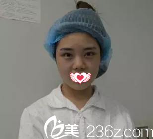 术前塌鼻 术前塌鼻