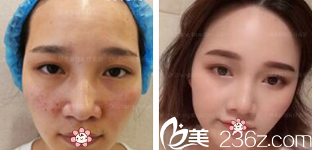 央金主任光电美肤案例