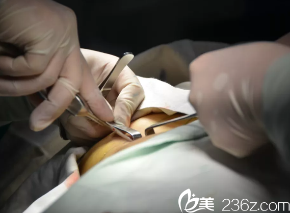 肋软骨提取过程中 肋软骨提取过程中