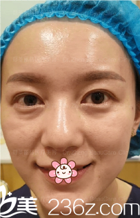 术前的我 术前的我