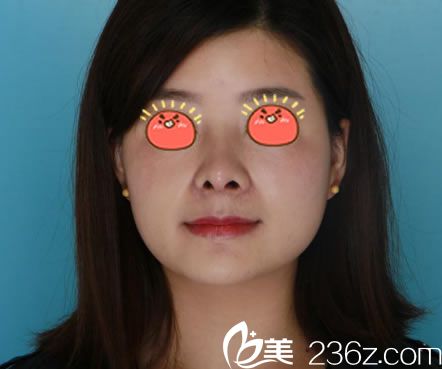 宁波薇琳隆鼻<span style=