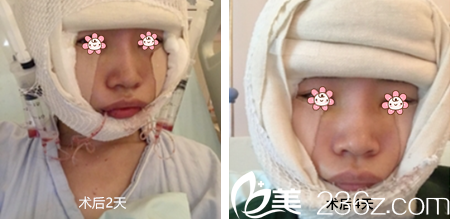 郑宰学院长刚给我做完手术没几天 郑宰学院长刚给我做完手术没几天