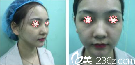 我的术前照片 我的术前照片