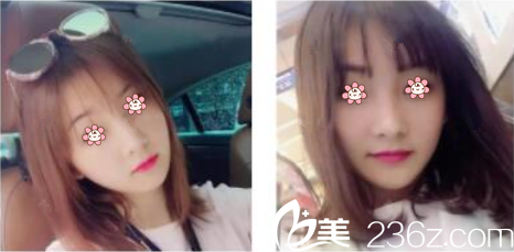 林钟学院长给我注射完一周 林钟学院长给我注射完一周