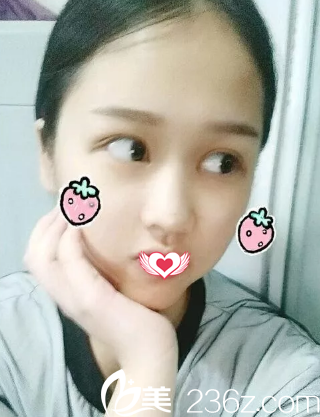 眼综合12天手术痕迹消失 眼综合12天手术痕迹消失