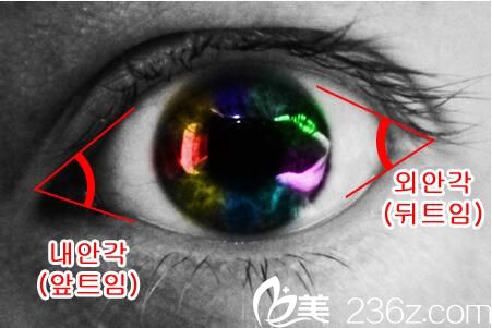 韩国李喜文整形医院李喜文开眼角 韩国李喜文整形医院李喜文开眼角