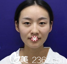 我的术前照 我的术前照