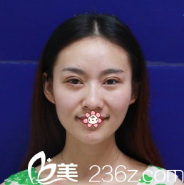 文晶焕院长给我术后第四天 文晶焕院长给我术后第四天