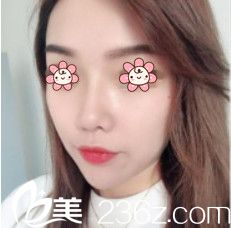 术后两个月效果