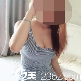 朴真奭自体脂肪隆胸术后一个月 朴真奭自体脂肪隆胸术后一个月