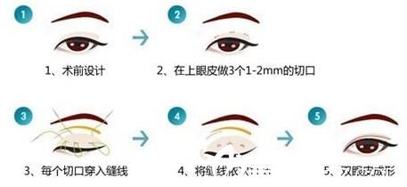 韩国休&美整形外科<span style= 韩国休&美整形外科<span style=