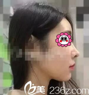 找怀化韩美做鼻综合一个月<span style= 找怀化韩美做鼻综合一个月<span style=