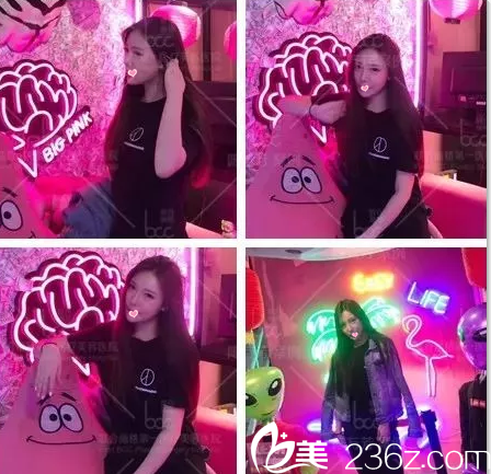 北京联合丽格3D童颜脂肪精雕术半个月效果