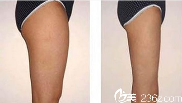 韩国美尔韩整形美体塑形 韩国美尔韩整形美体塑形