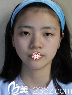 我是左眼睛小,右眼睛大... 我是左眼睛小,右眼睛大...