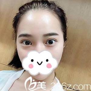 手术23天后的我