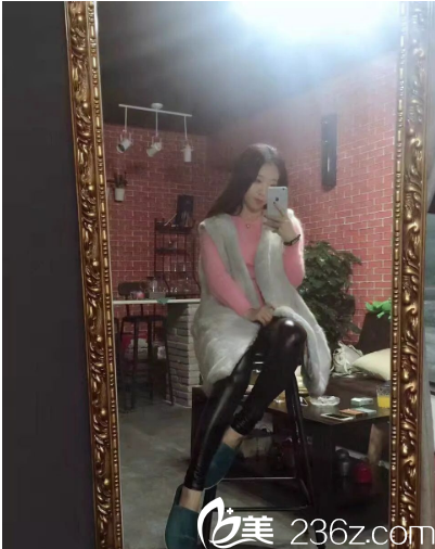 广州壹加壹大腿吸脂术后10天