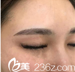 眉毛稀疏在韩国QT女性整形找崔贵东院长做半纹眉后眉目如画