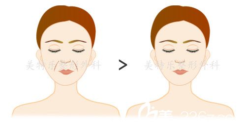 贵族手术 贵族手术