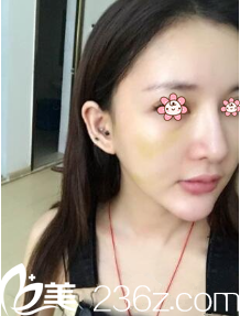 <!--<i data=20240703-sp></i>-->院长给我做完手术第五天 <!--<i data=20240703-sp></i>-->院长给我做完手术第五天