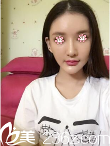 术后半个月 术后半个月