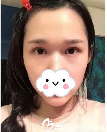 拉着老妈陪我去韩国尚美佳整形做了切开双眼皮，老妈说我变的比之前更可爱了