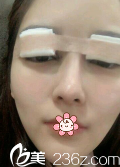 手术当天 手术当天