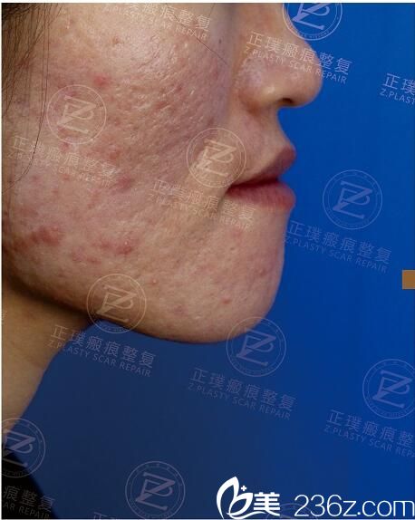 术前照片 术前照片