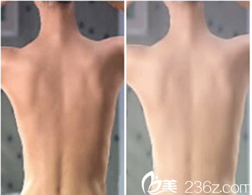 韩国延世SK整形医院注射案例对比效果 韩国延世SK整形医院注射案例对比效果