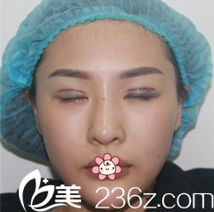 金阳洙院长给我手术当天