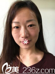 以前显老的我 以前显老的我