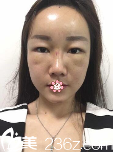 刚做完填充 刚做完填充