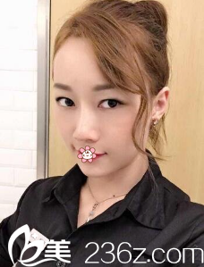 <!--<i data=20240703-sp></i>-->做自体脂肪填充怎么样 <!--<i data=20240703-sp></i>-->做自体脂肪填充怎么样