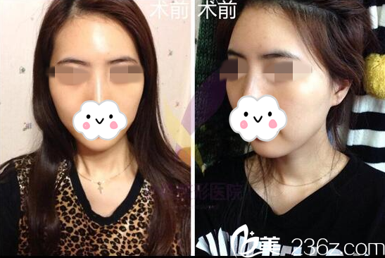 手术前的我 手术前的我