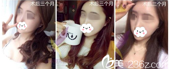 术后三个月 术后三个月