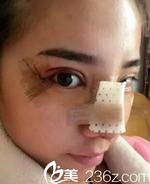 <!--<i data=20240703-sp></i>-->做眼鼻整形手术 <!--<i data=20240703-sp></i>-->做眼鼻整形手术